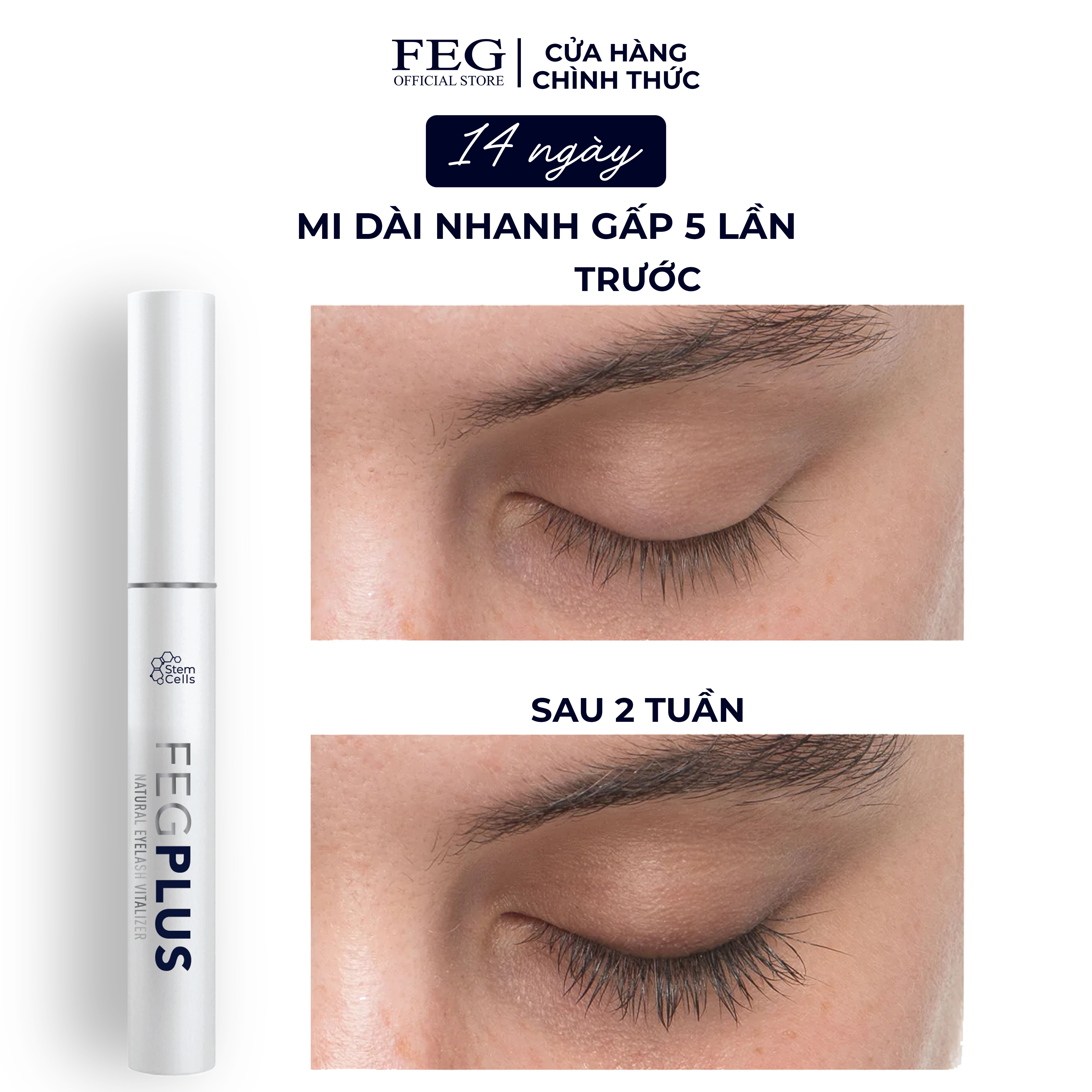 Dưỡng mi tế bào gốc FEG Plus Stem Cells ban ngày - Dài mi sau 14 ngày, không chứa Prostaglandins gây thâm mắt (5ml)