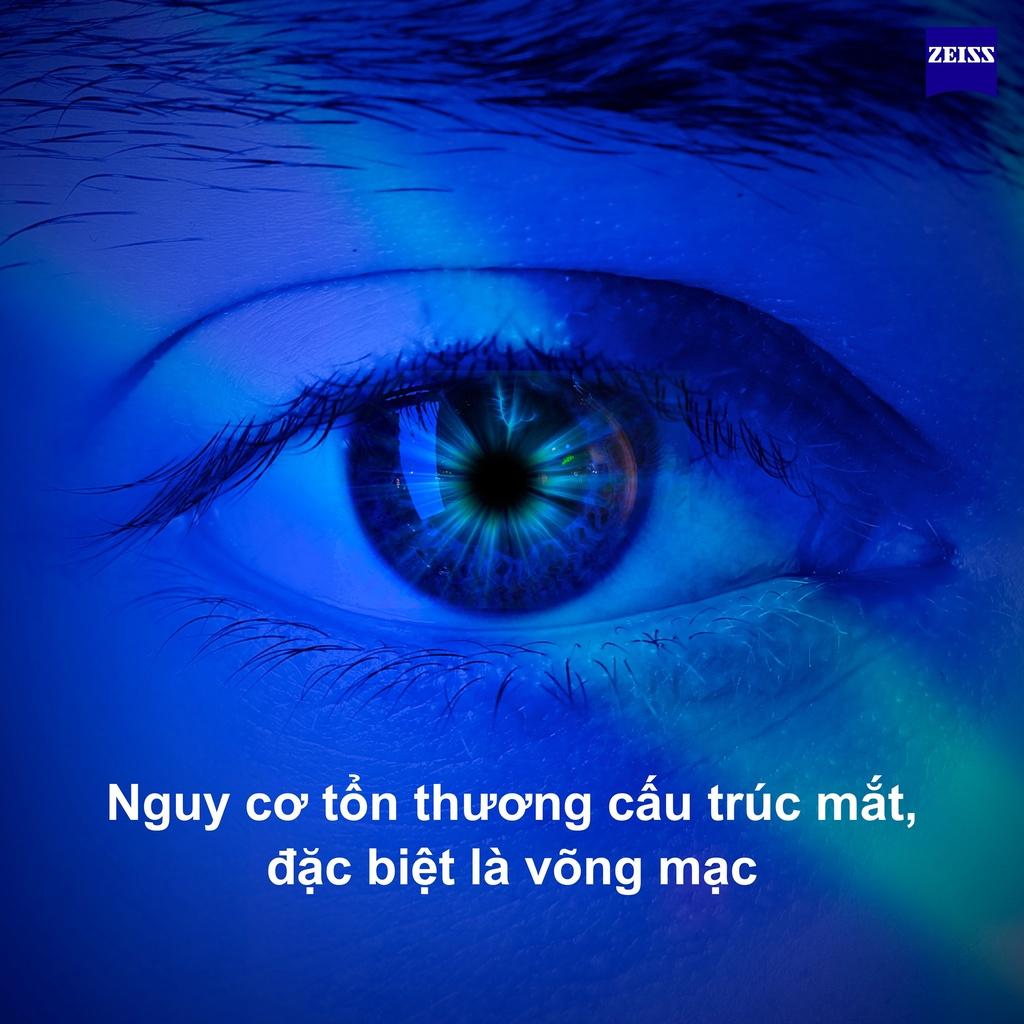 Tròng Kính Zeiss Duravision Blue Protect UV Chính Hãng Đức