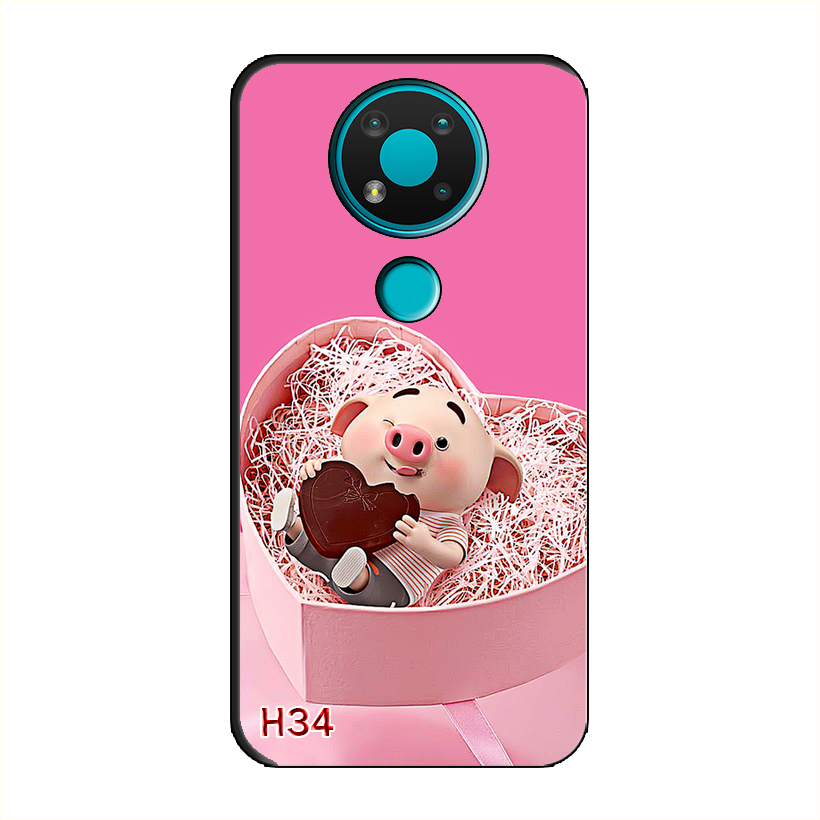 Ốp Dẻo Dành Cho NOKIA 3.4