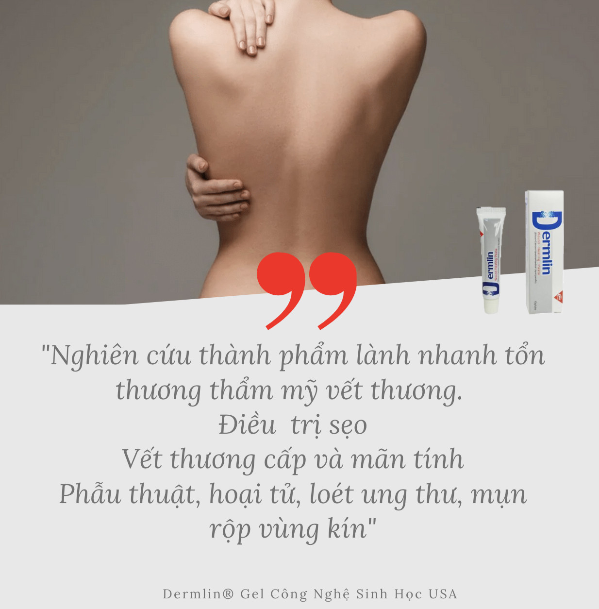 Combo 5 Dermlin Gel Công Nghệ USA Liền Nhanh Vết Thương Hở, Phẫu Thuật, Viêm Loét Cấp và Mãn Tính. Collagen II, III, phòng và trị sẹo