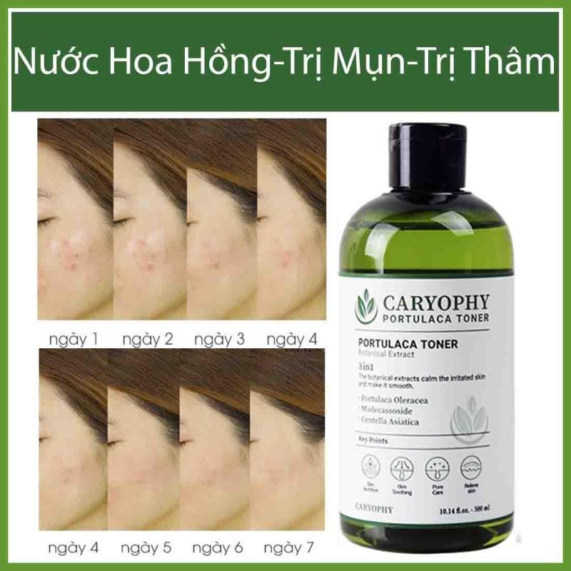 Combo 2 Sản Phẩm Hỗ Trợ Giảm Mụn Và Tẩy Da Chết Dịu Nhẹ Caryophy (Tẩy trang 500ml + Toner 300ml)