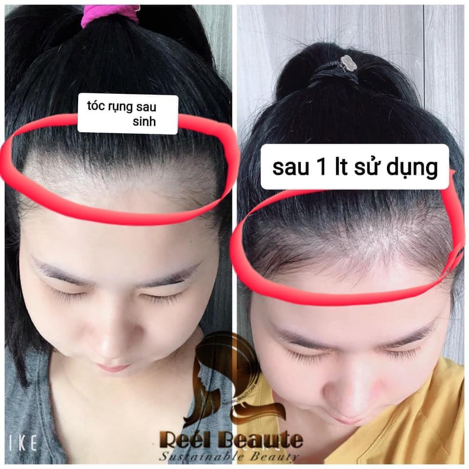 TÚI LỌC GỘI ĐẦU THIÊN NHIÊN REE'L BEAUTE - DÒNG CAO CẤP