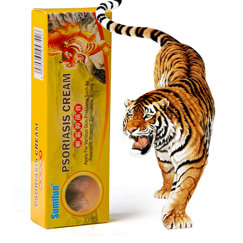 Kem hỗ trợ bôi vảy nến, ngứa do nấm, viêm da, tinh chất thảo dược thiên nhiên, tặng kèm vòng tay Luminous