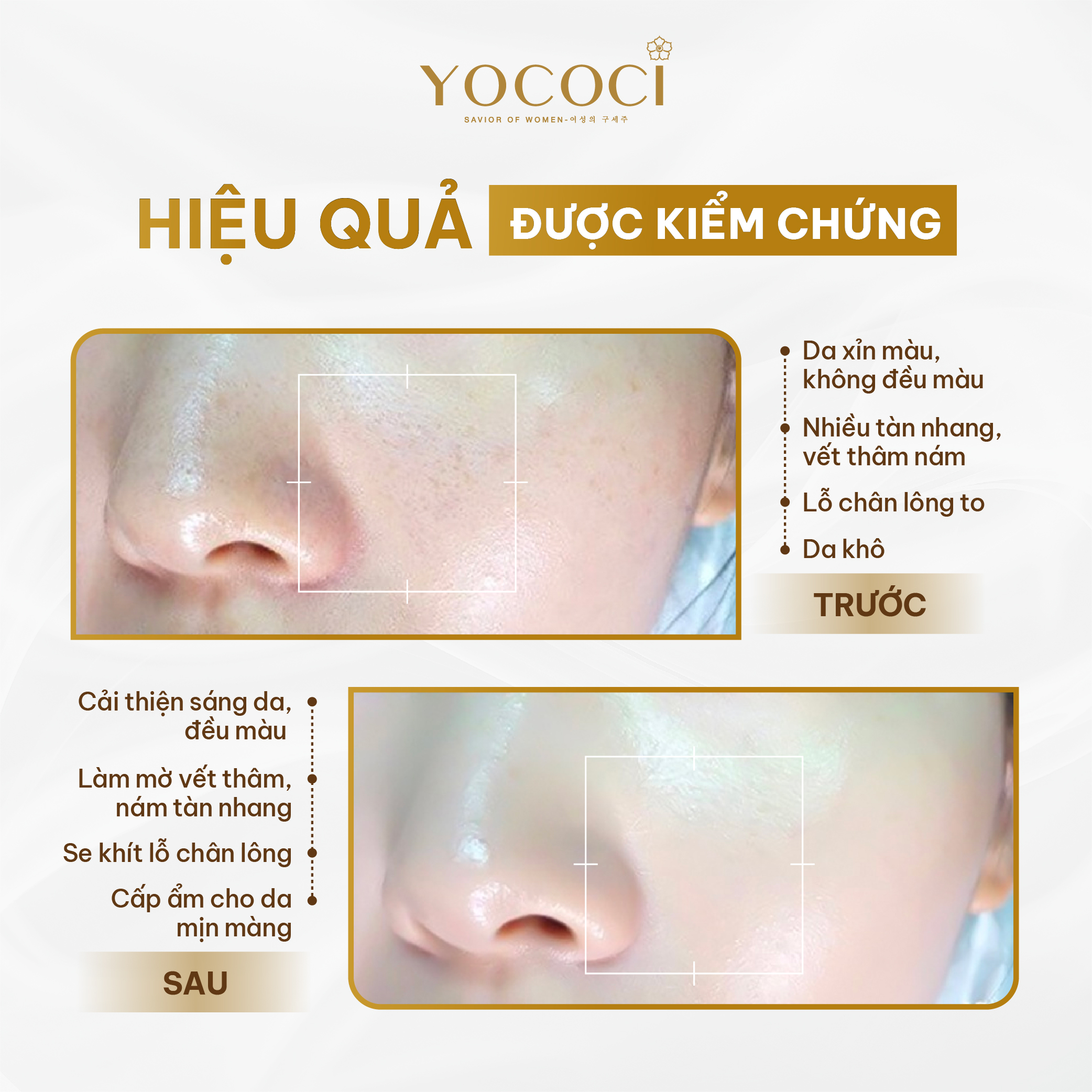 Kem dưỡng trắng Yococi sáng da mờ thâm sạm, nám ngừa lão hoá White Perfect Face Cream Day Night 20g