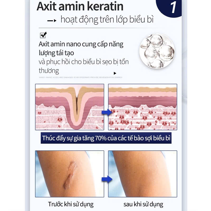 Kem Bôi Xóa Mờ Sẹo Thâm, Sẹo Lồi, Mụn Và Bỏng Hiệu Quả Nhanh Chóng Cải Thiện Làn Da Rõ Rệt