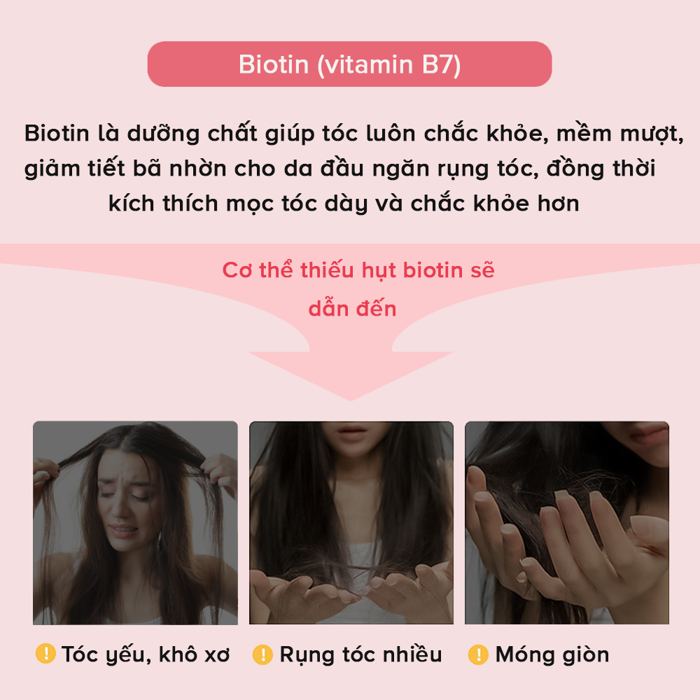 Viên uống Biotin DHC Nhật Bản kích thích mọc tóc nhanh và dày, dưỡng da, móng khỏe mạnh JN-DHC-B30 (30 ngày)