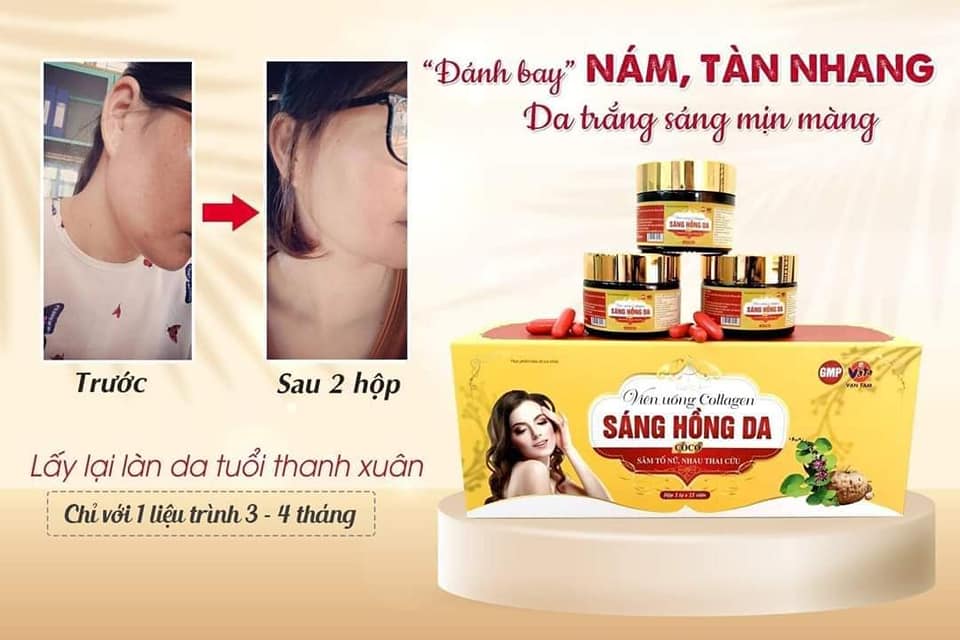 Viên uống giảm sạm nám tàn nhang Sáng Hồng Da CoCo tinh chất sâm tố nữ giúp đẹp da ngăn ngừa lão hóa