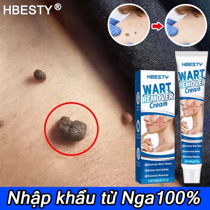 Serum Kem bôi xóa bỏ mụn cóc mụn thịt nốt ruồi trên da loại tốt hiệu quả từ thảo dược thiên nhiên không gây sẹo