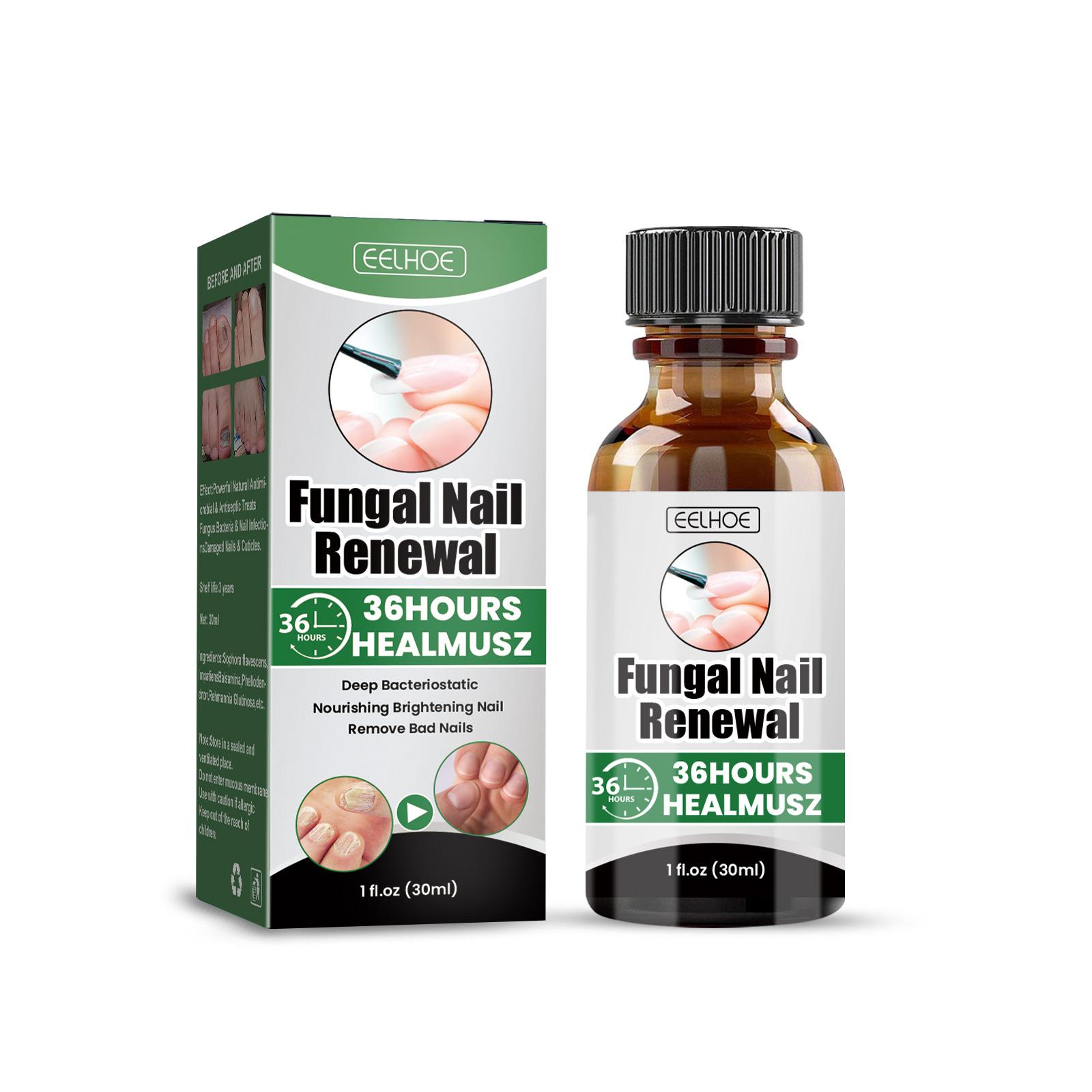 EELHOE 30ml Nail Treatment Essence for Onychomycosis Mild Non-irritating Nail Bright Shiny Repair Nail Repair Solution