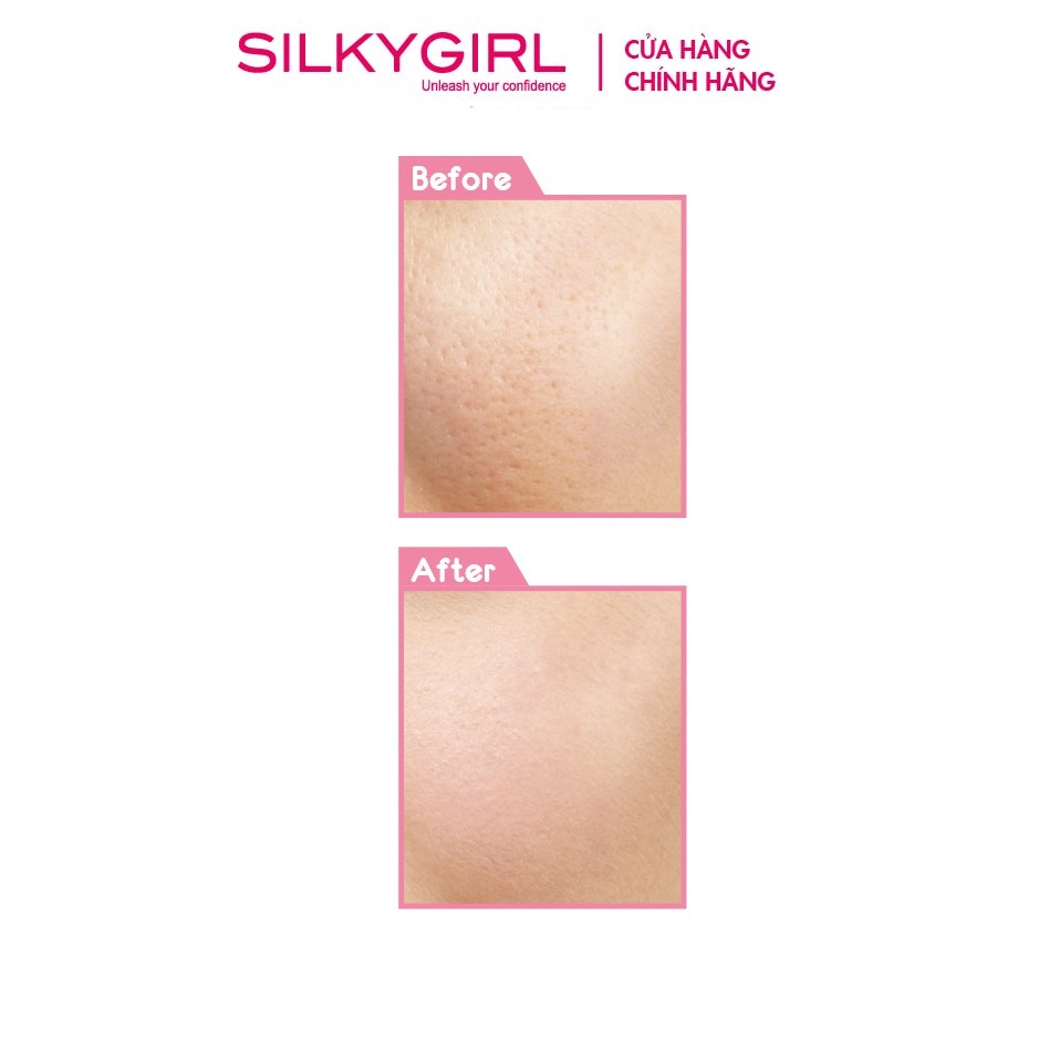 Kem Lót Che Lỗ Chân Lông Silkygirl Instant Pore Fix Primer 15ml