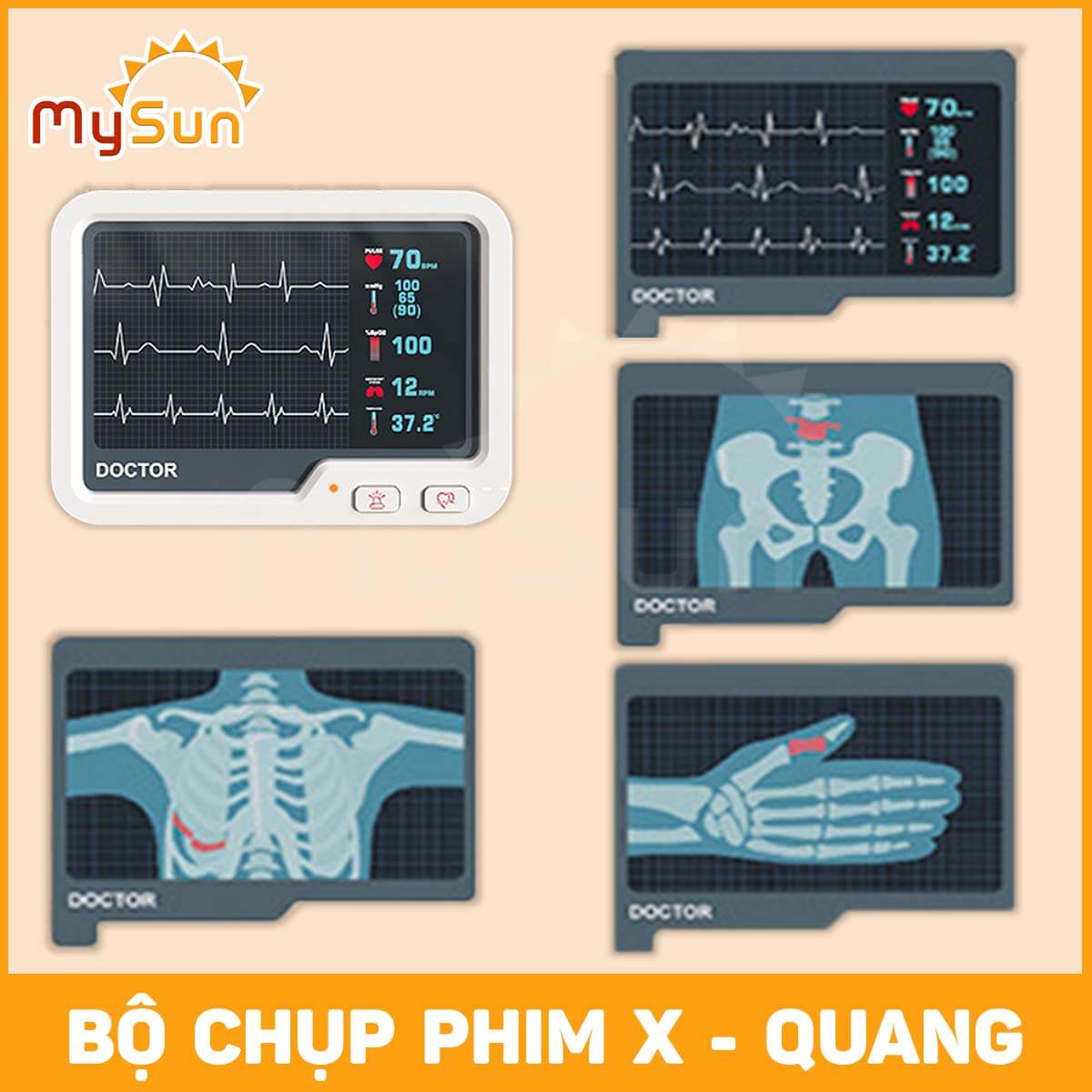 Bộ đồ chơi bác sĩ có xe đẩy nhập khẩu cao cấp cho bé trai, gái MySun