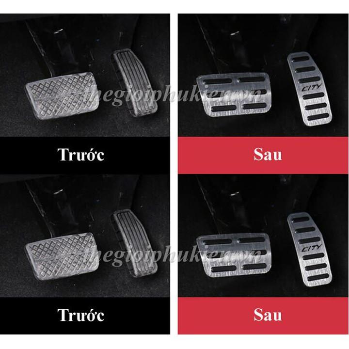 Bộ ốp bọc chân ga, chân phanh Honda City 2015-2019