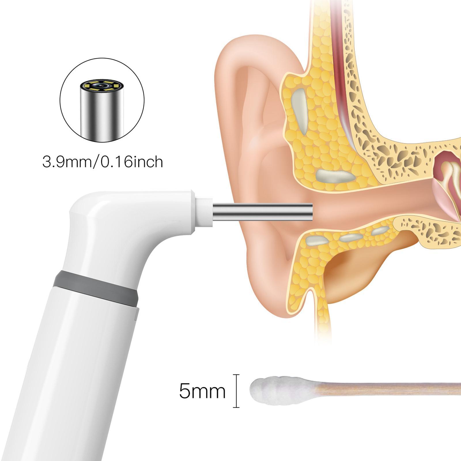 WiFi Wireless with Camera Ear Cleaner Endoscope for Kids Adults