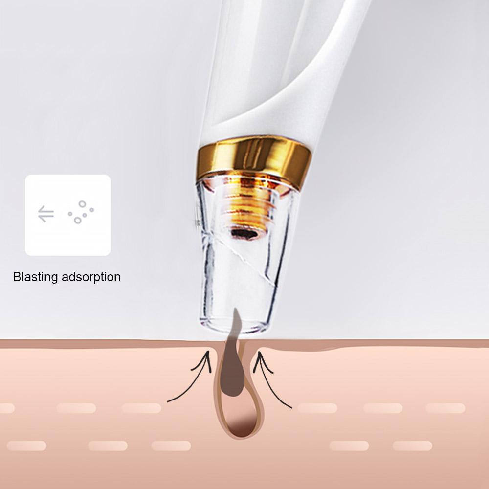 Máy làm sạch mụn đầu đen