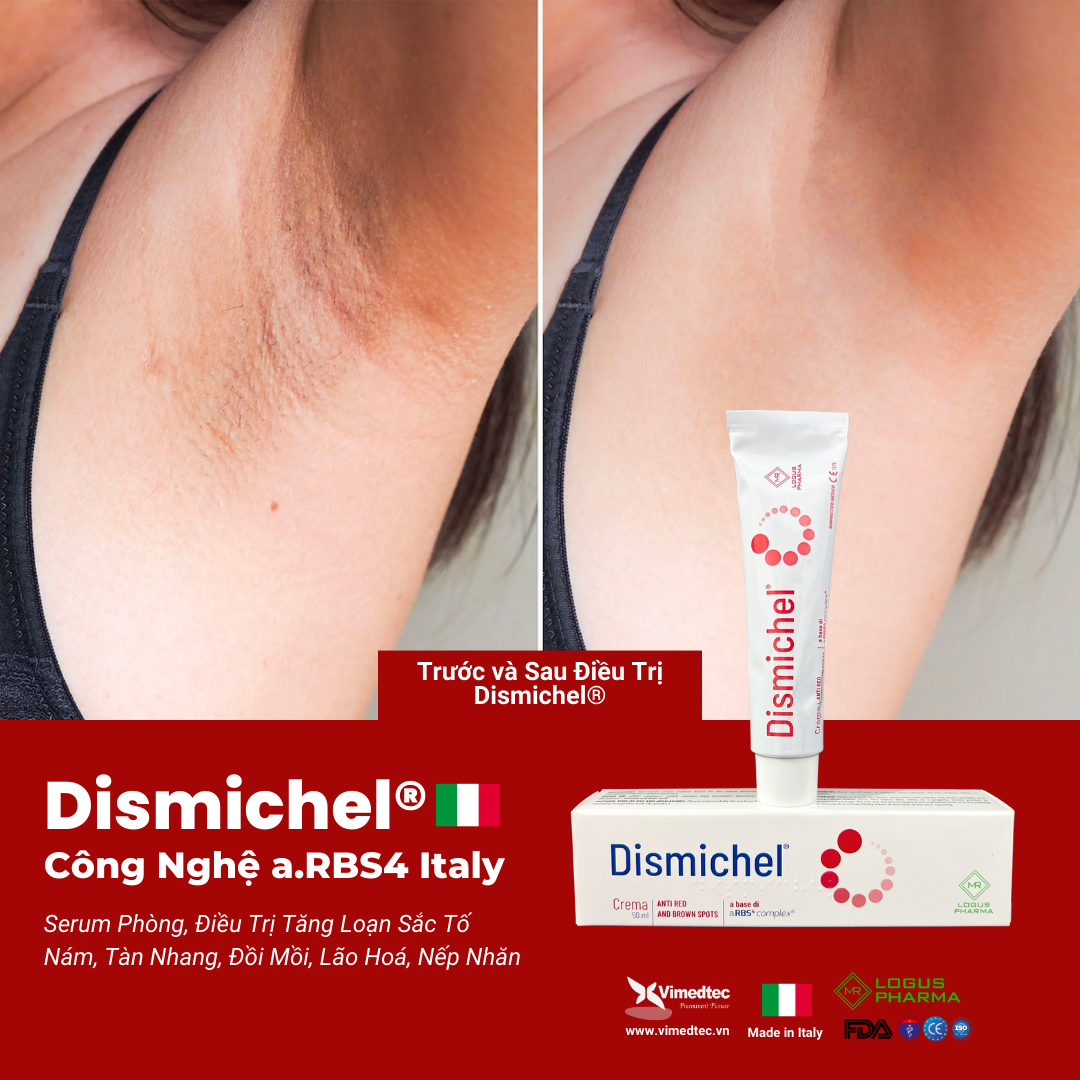 Dismichel Kem Serum Chống Lão Hoá Dưỡng Trắng Đều Màu Da Loạn Tăng Sắc Tố Hemosiderin Và Melanin Nám, Rạm, Tàn Nhang, Đồi Mồi, Quầng Thâm Toàn Thân, Sẹo, Tăng Sinh Tế Bào, Thẩm Thấu Dưỡng Ẩm Sâu. Viêm Da. Phục Hồi Tổn Thương Thẩm Mỹ. Nhập Khẩu Italy