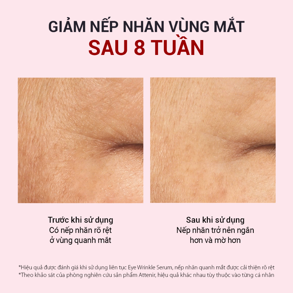 Tinh chất cải thiện nếp nhăn dưỡng ẩm vùng mắt 15g Attenir Eye Wrinkle Serum