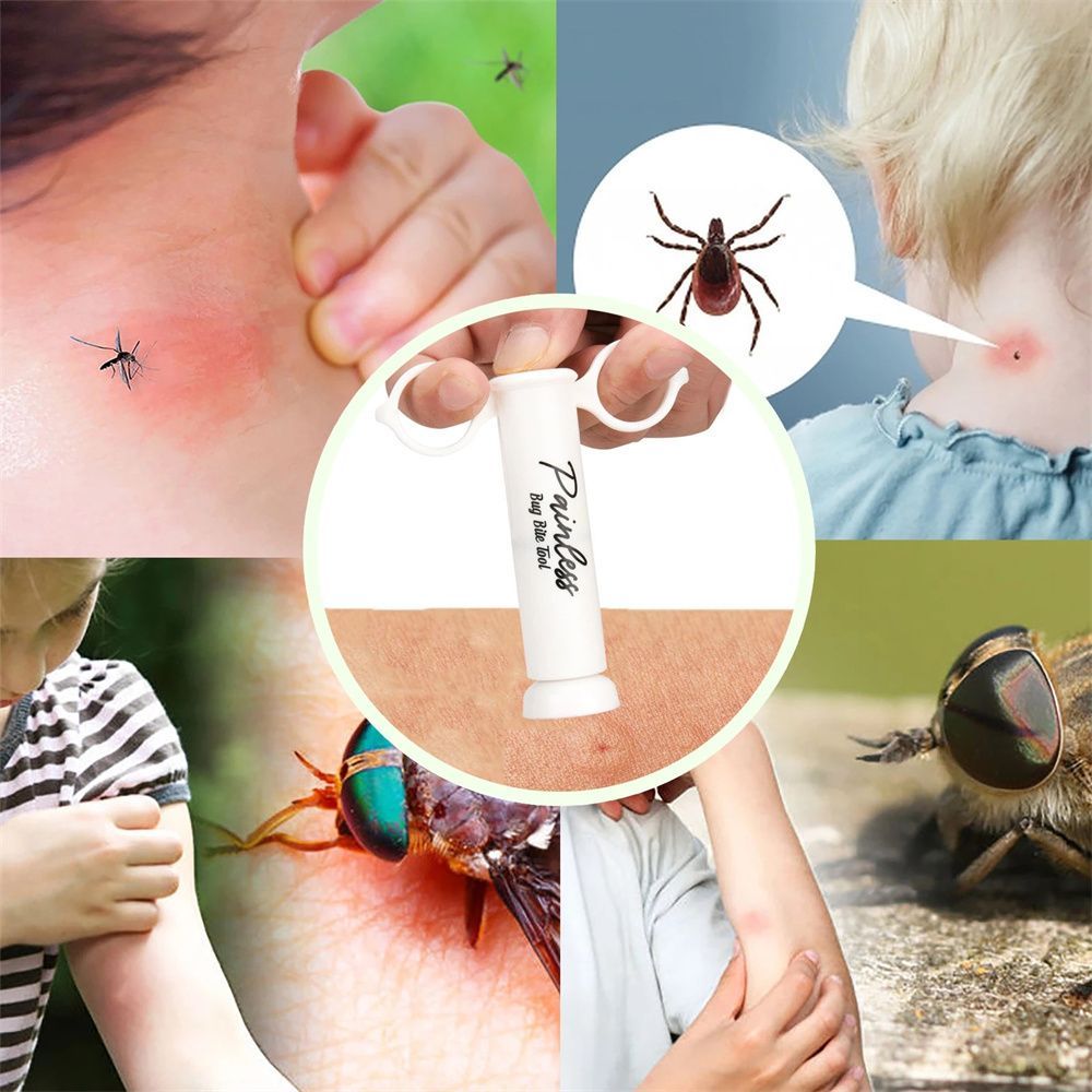 Dụng cụ hút độc ngoài da do côn trùng cắn Insect Sting Sucker loại bỏ nọc độc của côn trùng, nước bọt và các chất kích ứng khác còn sót lại dưới da