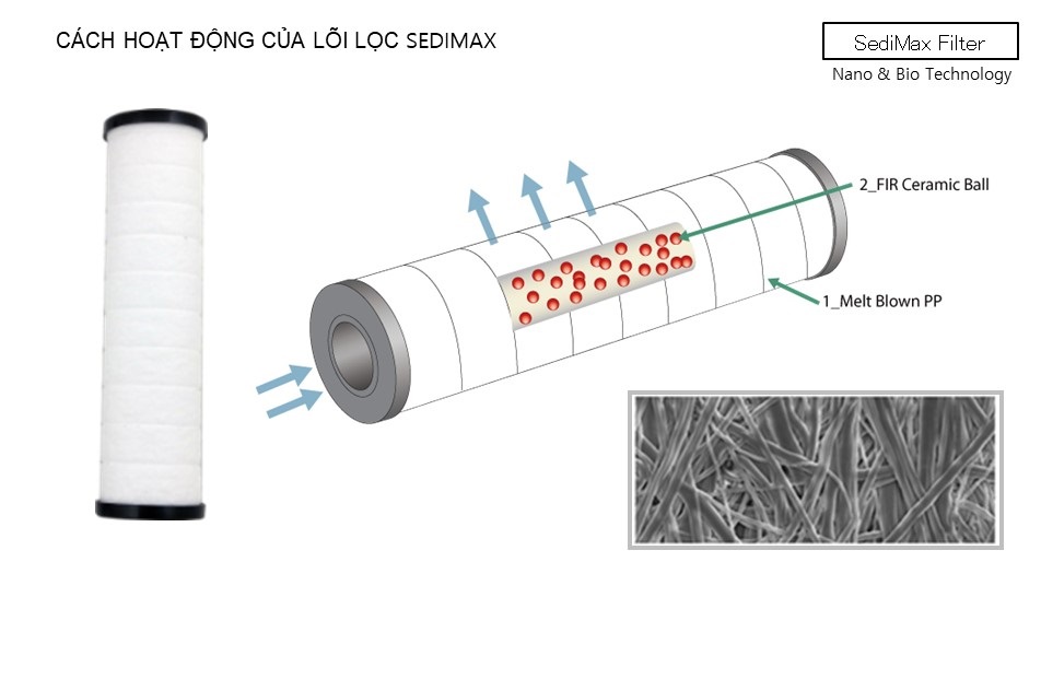 Bộ 3 lõi lọc Sedimax Sonaki ( SMF-03)