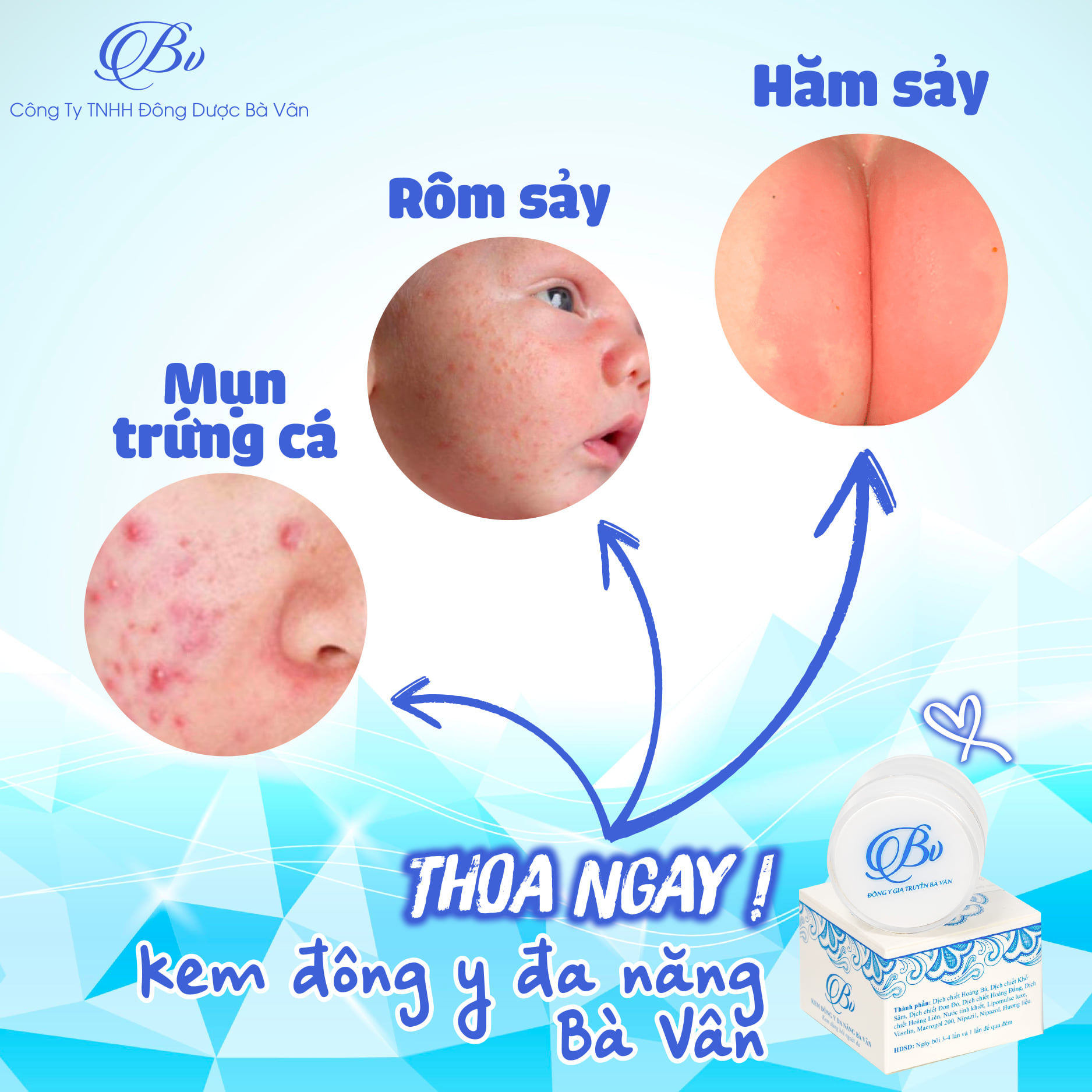 Kem Đông Y Đa Năng Bà Vân, Giải quyết tất cả các vấn đề về da cho Bé &amp; cho cả gia đình - An toàn, lành tính - Sản phẩm của đông dược Bà Vân