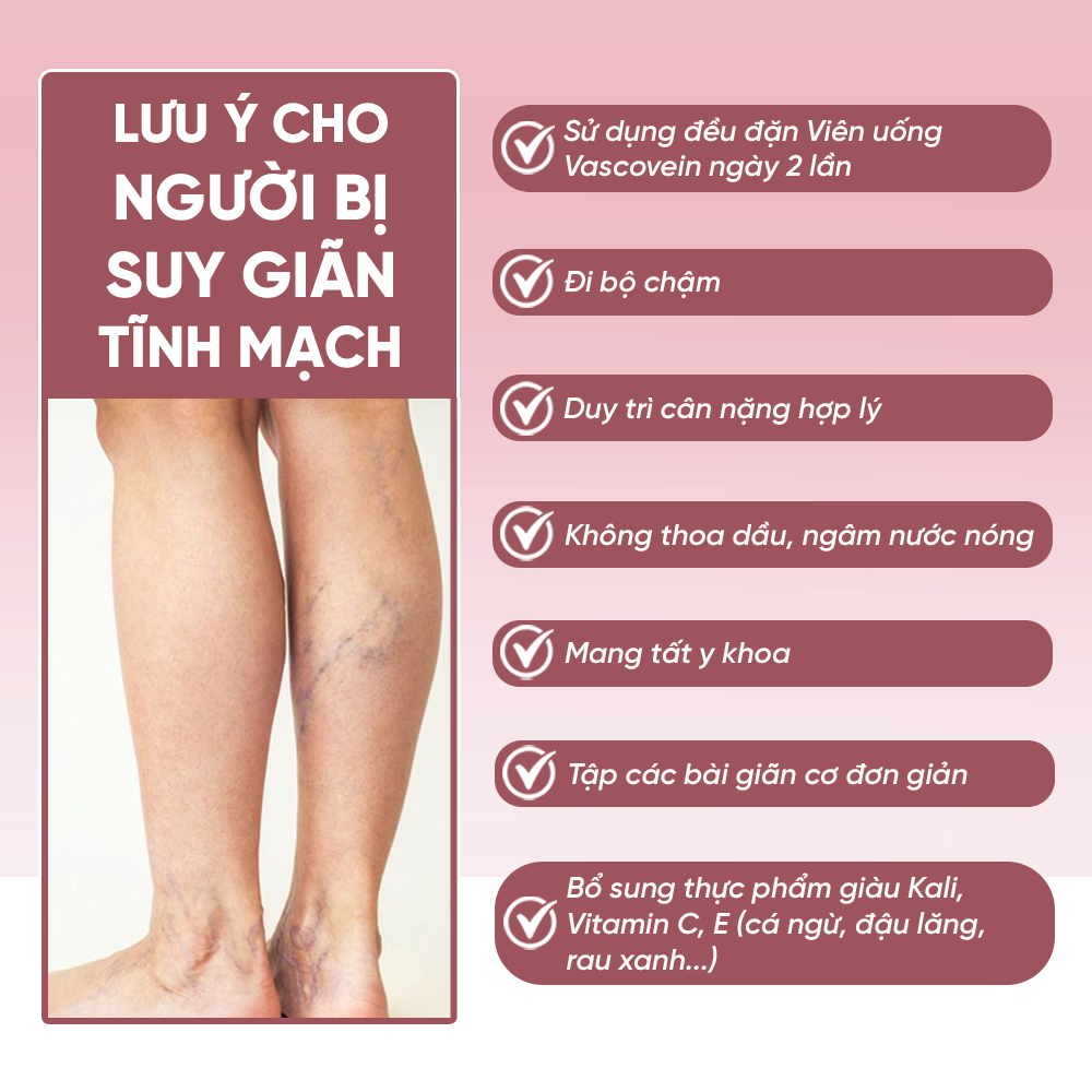 Liệu Trình Cải Thiện Suy Giãn Tĩnh Mạch Vascovein Giảm Đau Và Làm Mờ Gân Xanh Do Suy Giãn Tĩnh Mạch