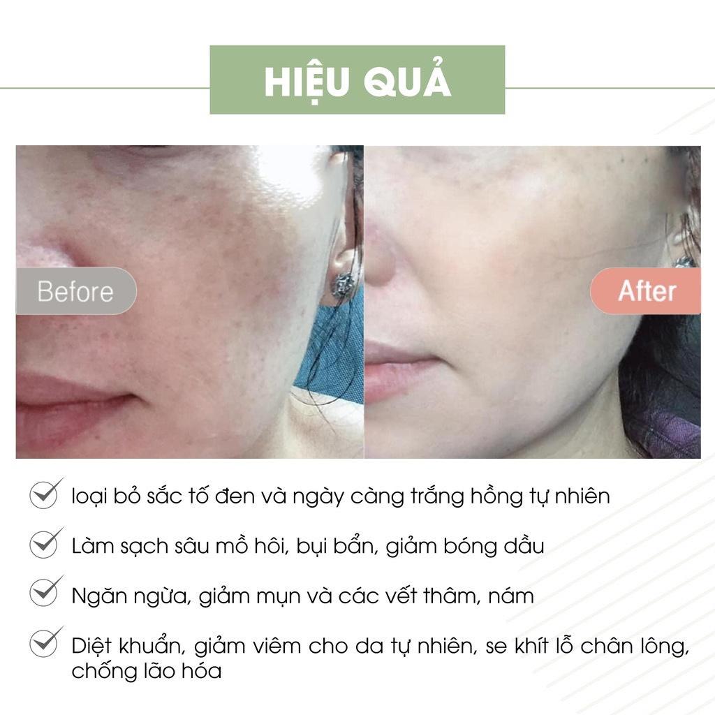 Kem Face Pháp Acosmetics - Kem dưỡng trắng da mặt - 20g - Giúp ngăn ngừa mụn, thâm nám tàn nhang,Hiệu quả chỉ sau 1 tuần