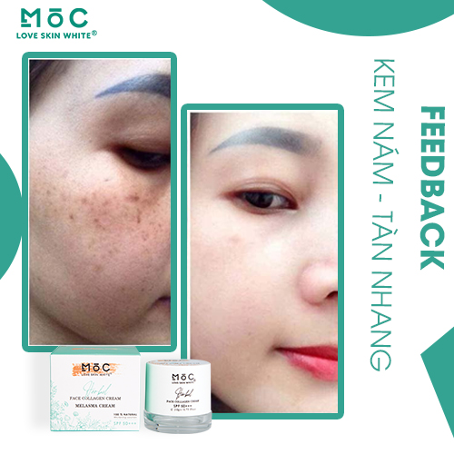 KEM NGỪA NÁM - TÀN NHANG, ĐỒI MỒI -COLLAGEN 20G - MỘC