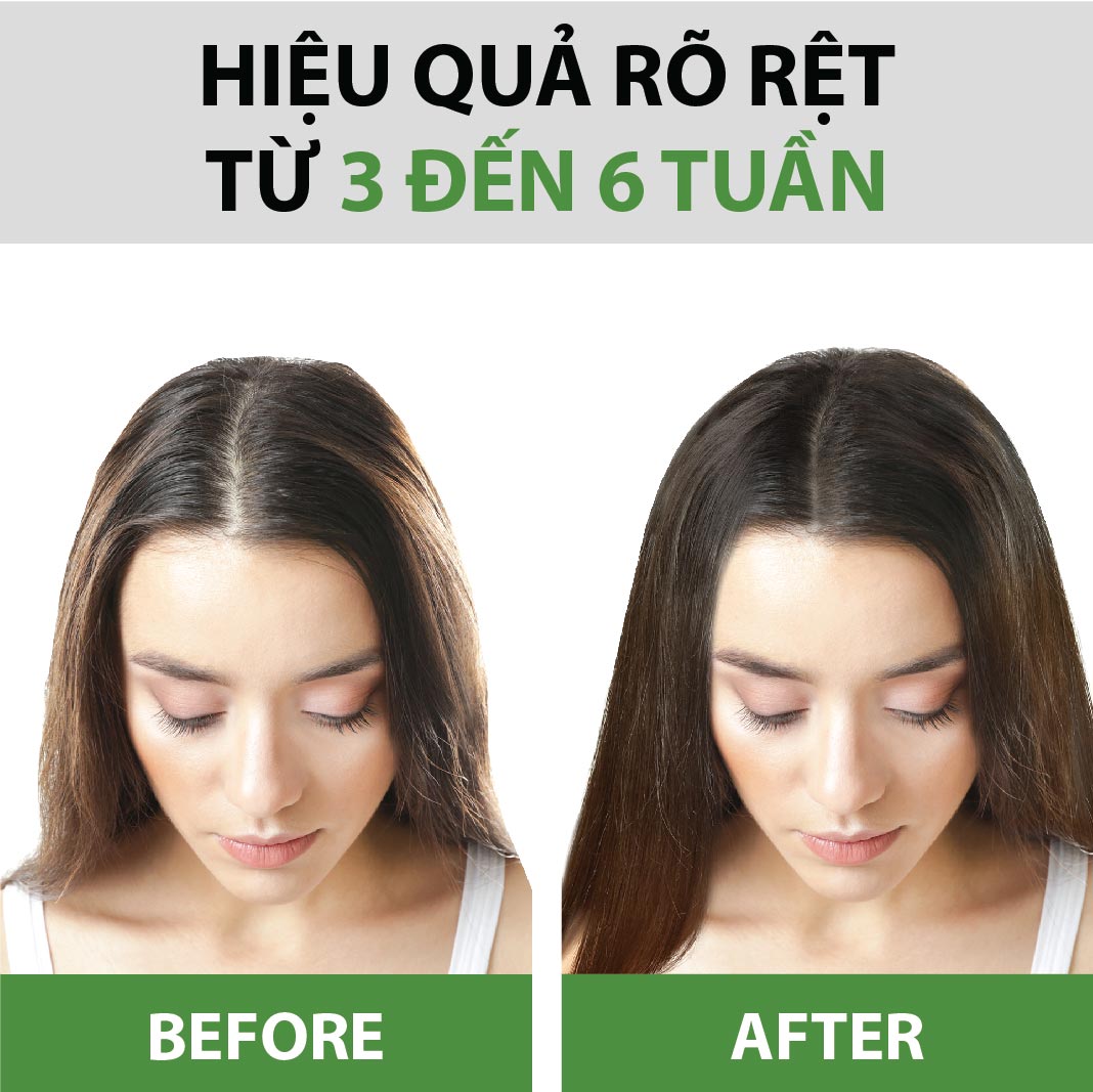 Combo 2 Serum Bưởi Kích Thích Mọc Tóc Milaganics