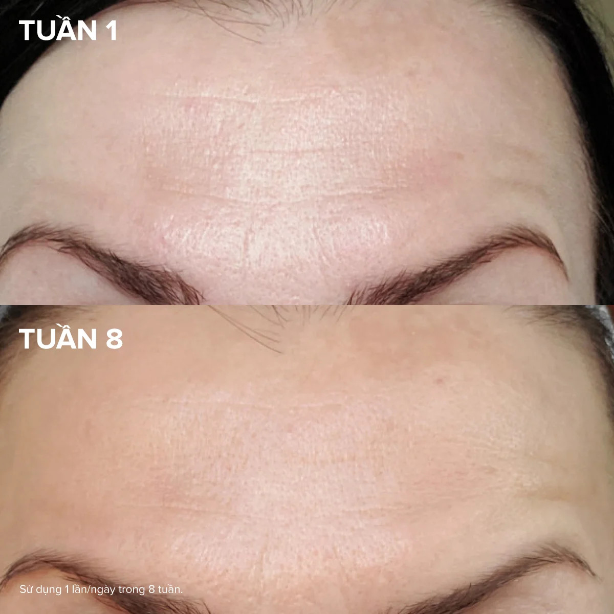 Tinh Chất Làm Căng Mịn & Săn Chắc Làn Da Pro-Collagen Multi-Peptide Booster 30ml