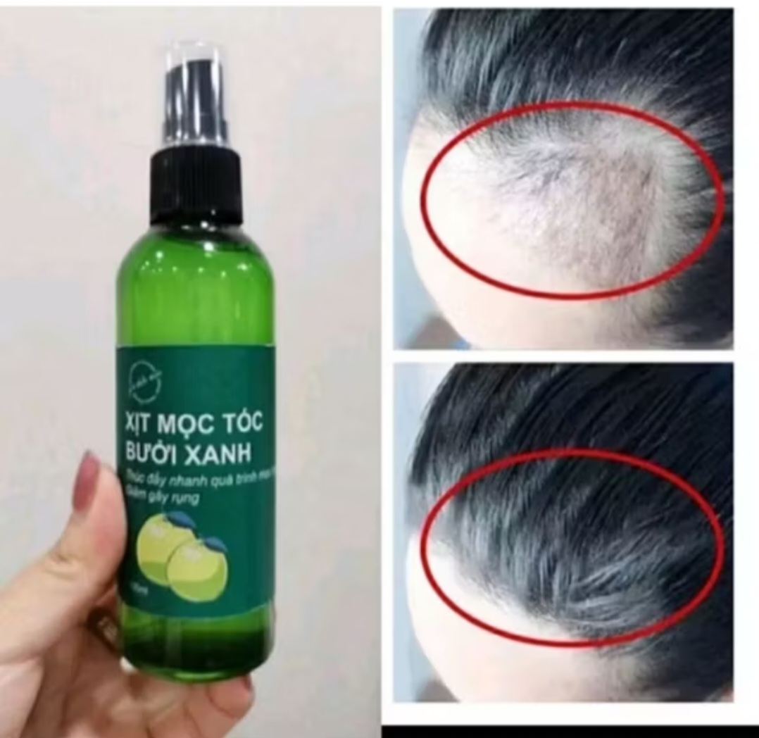 1 CHAI TINH DẦU THẢO MỘC XỊT KÍCH THÍCH MỘC TÓC CAO CẤP CHO MỌI GIA ĐÌNH