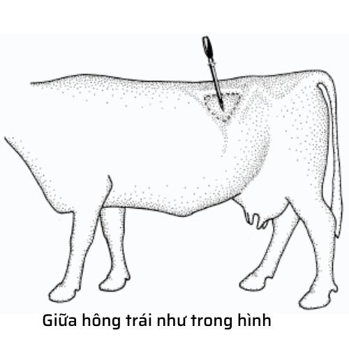 Troca thông hơi dạ cỏ trâu bò pháp - kèm 3 kim 11cm 13cm 14,5cm