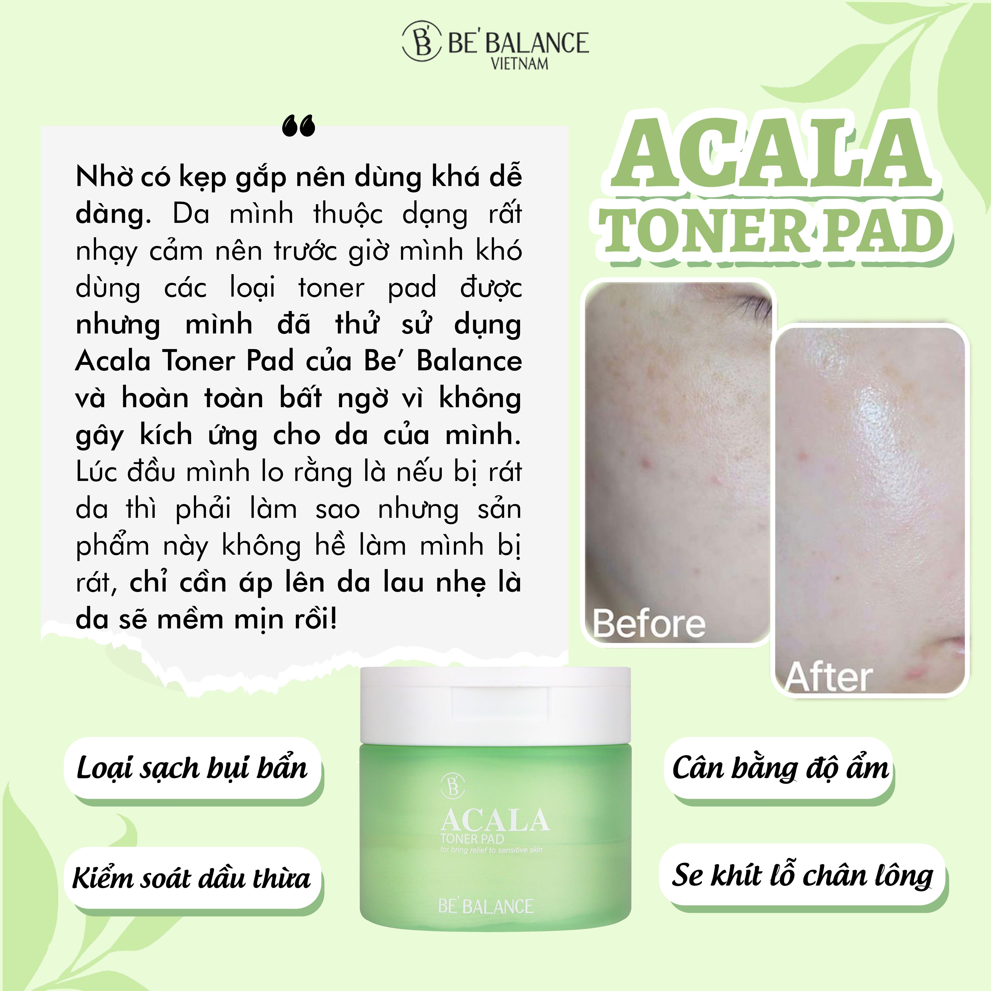 Nước cân bằng da BEBALANCE Acala Toner Pad 150ml