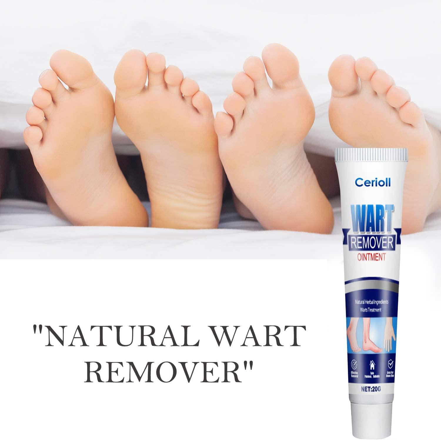 Mụn cóc, Chống mụn cóc ở chân, Không mụn cóc, góc, Chống mụn cóc ở tay/chân, Chống mụn cóc, Ngừng mụn cóc, Chống mụn cóc, Chăm sóc mụn cóc/ngô/chân