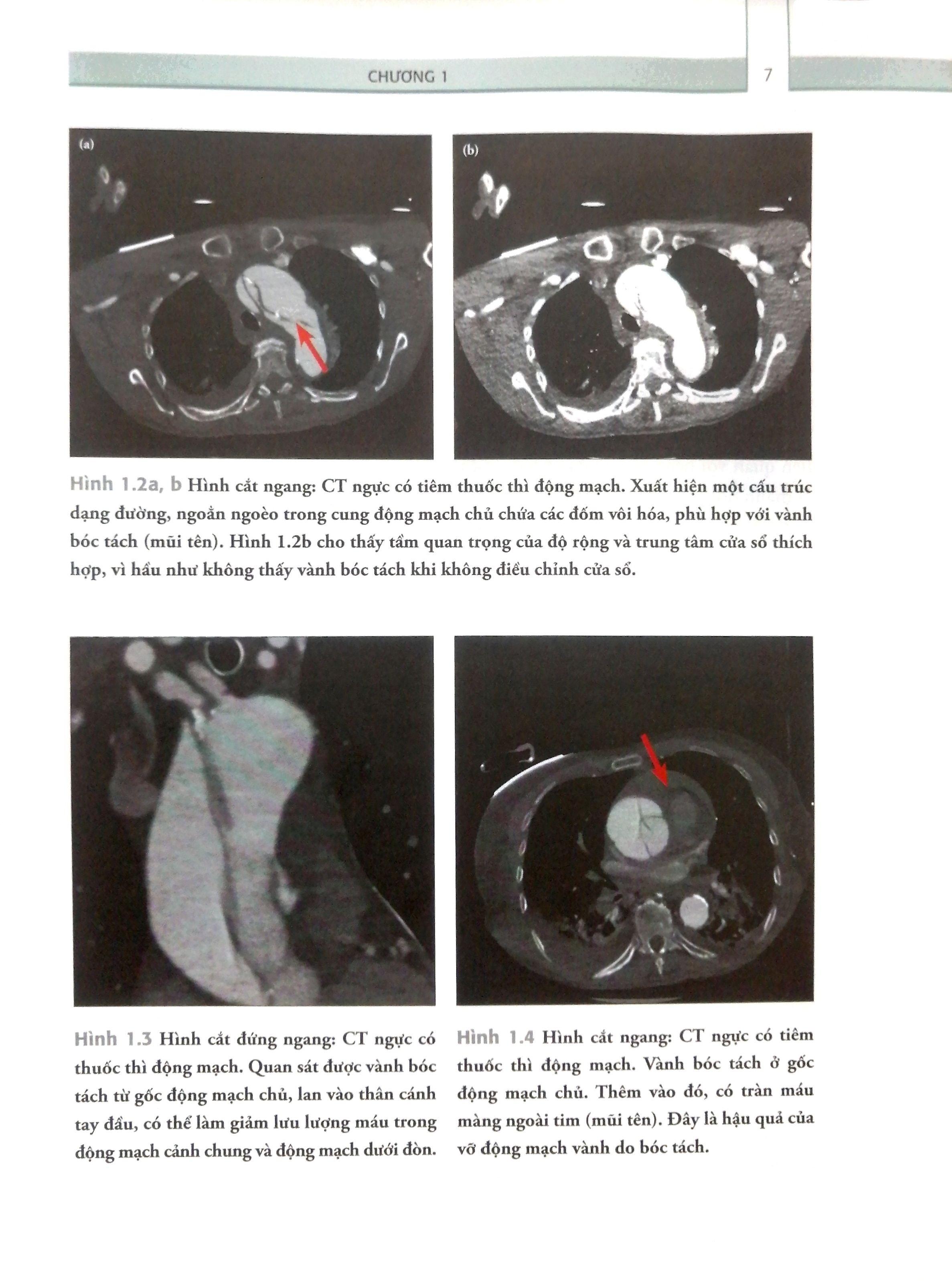 Sách Cẩm Nang Trực Chẩn Đoán Hình Ảnh