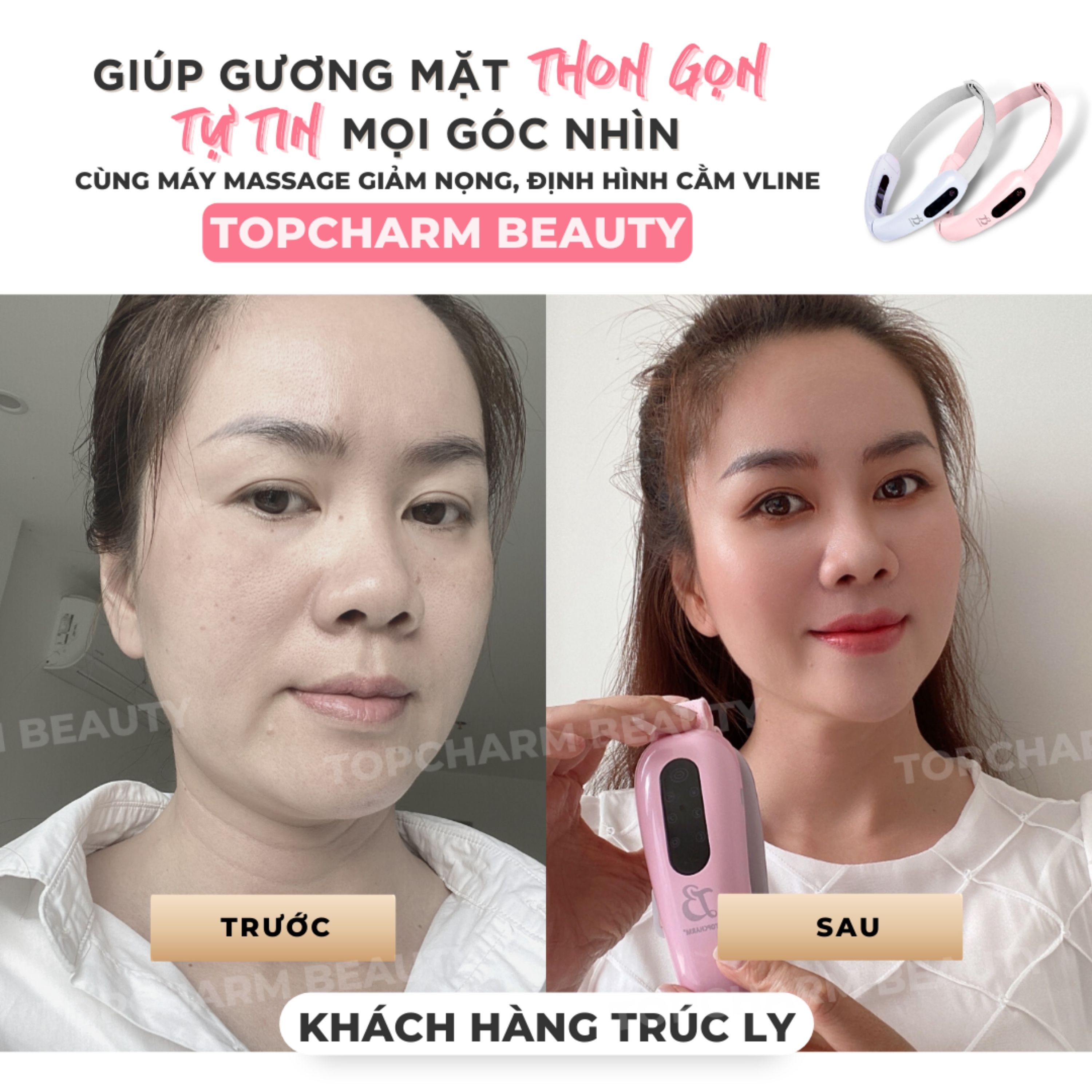 Máy nâng cơ trẻ hoá da giúp thon gọn tạo cằm V-Line TOPCHARM