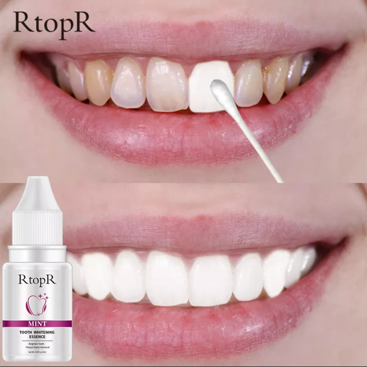 Serum tinh chất làm trắng răng loại bỏ mảng bám, vết bẩn ố vàng cho bạn hàm răng trắng sáng tinh khôi loại tốt 10ml