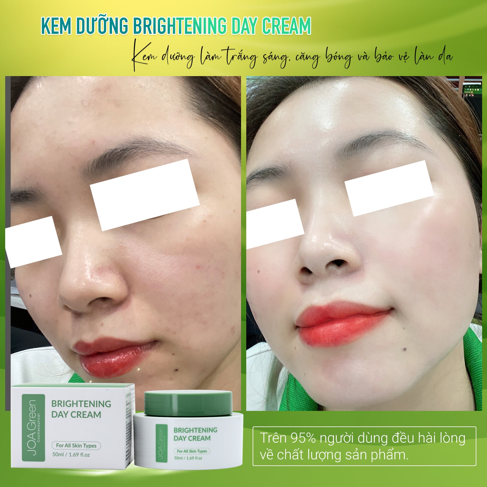 Kem Dưỡng Da Mặt Brightening Day Cream 50ml - JOA GREEN Giúp Phục Hồi, Dưỡng Trắng Da Và Cải Thiện Nếp Nhăn – Mỹ Phẩm MS COSMETIC