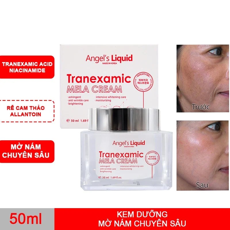 Kem Dưỡng Mờ Nám Chuyên Sâu Angel's Liquid Tranexamic Mela Cream 50ml