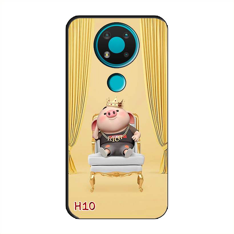 Ốp Dẻo Dành Cho NOKIA 3.4