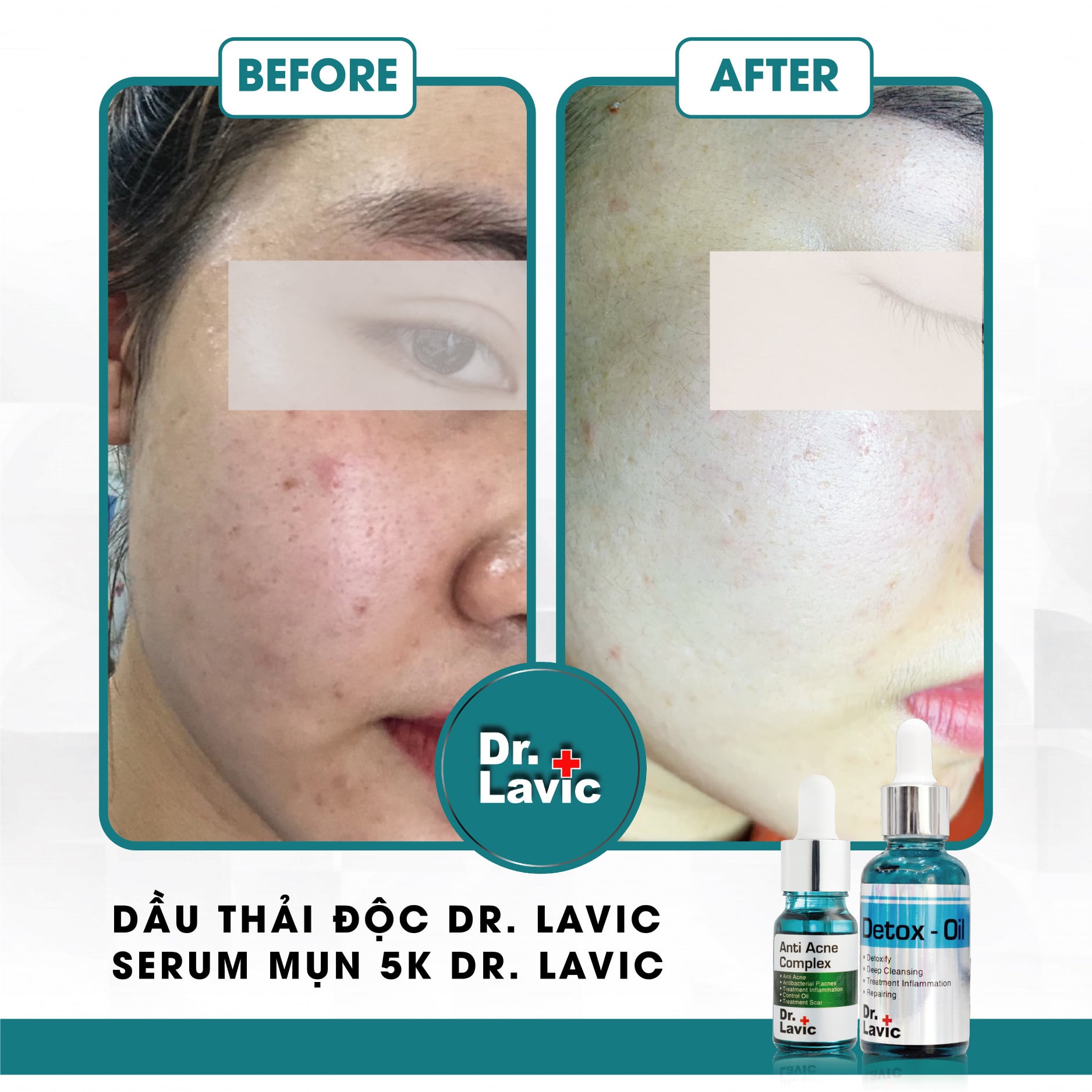 DẦU THẢI ĐỘC DR.LAVIC - Dr.Lavic detox-oil