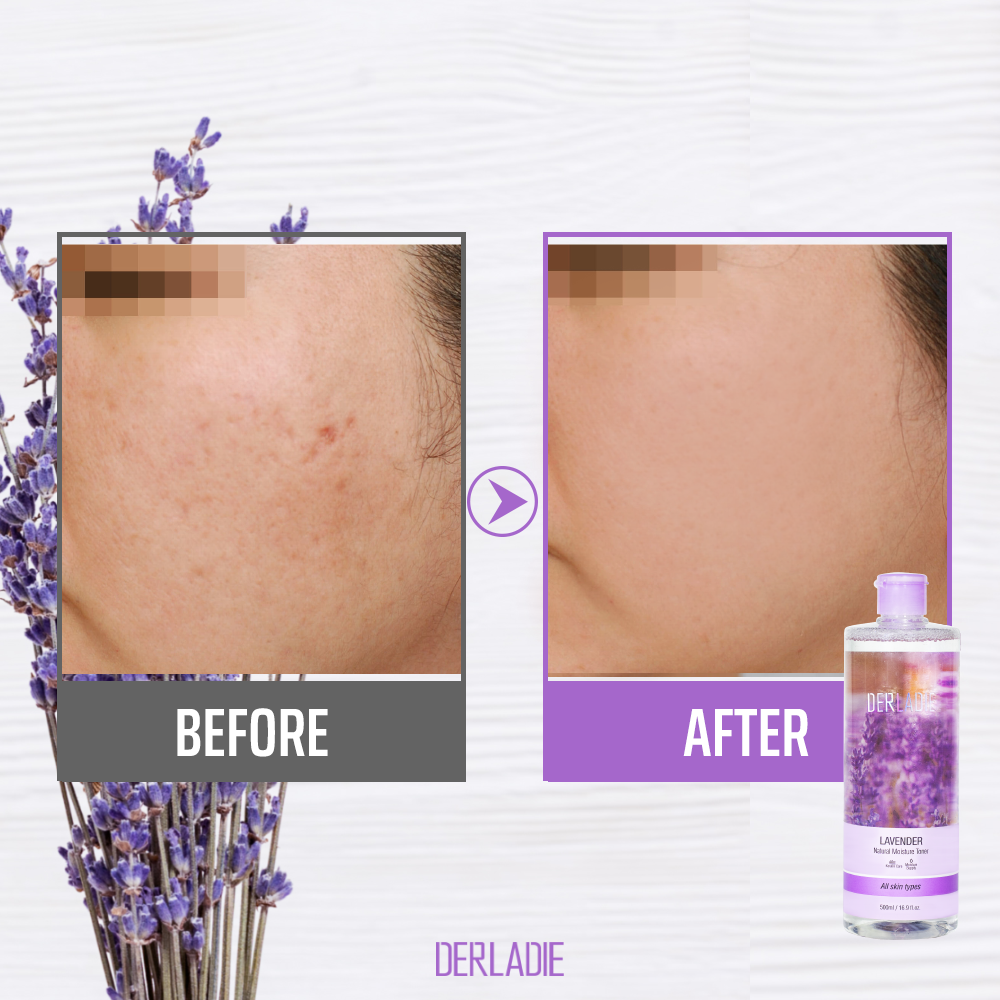 Toner Nước Hoa Hồng Lavender Oải Hương Derladie Natural Moisture Toner 500ml Nhập Khẩu HÀN QUỐC CHÍNH HÃNG