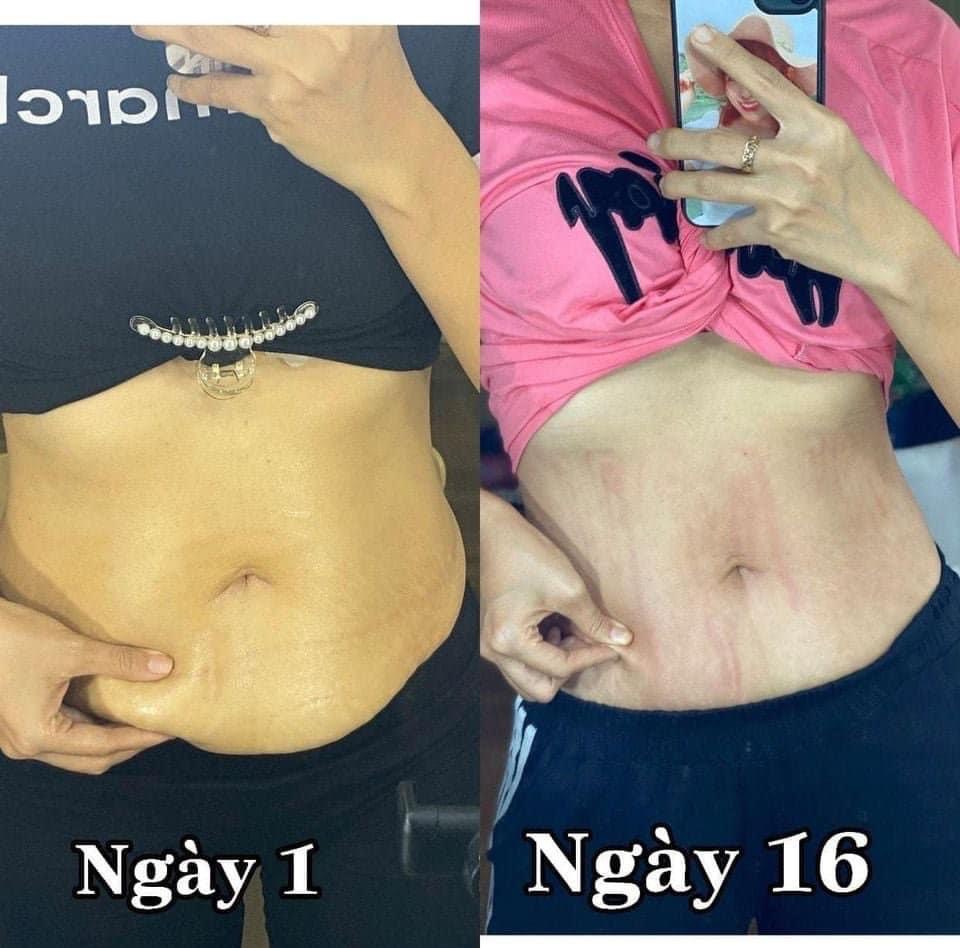 BỘ Ủ NÓNG TAN MỠ SLIMMING BODY SBII .
