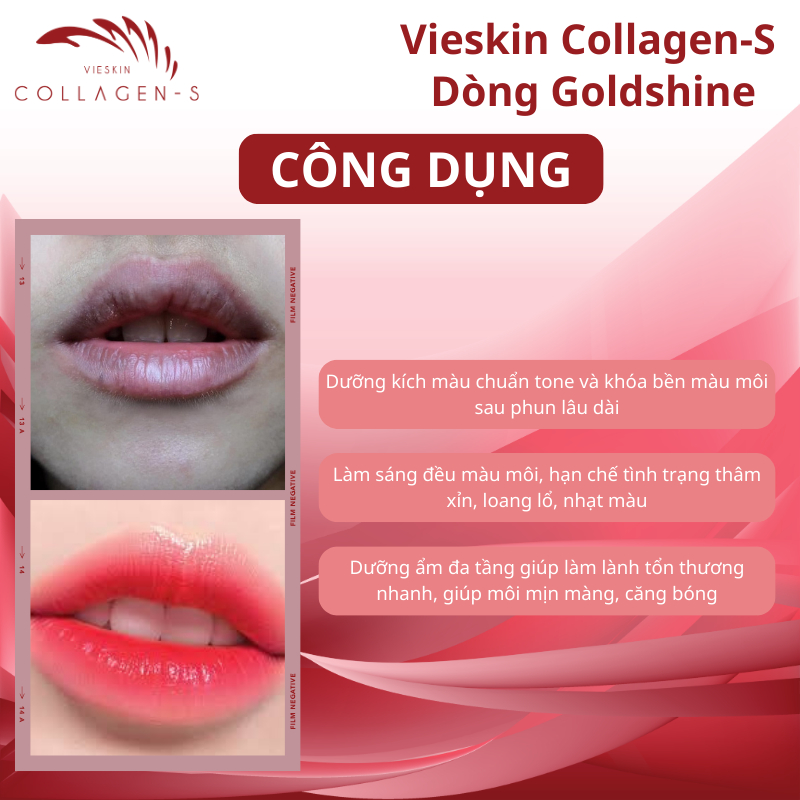 Tinh chất dưỡng kích màu môi sau phun xăm Vieskin GoldShine, collagen tươi kích màu sắc nét, tự nhiên, căng bóng, 7ml