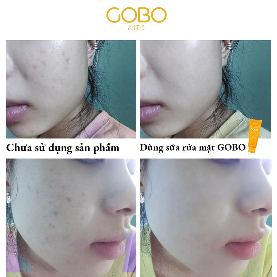 Quà tặng cho nàng - Sữa rửa mặt GOBO hỗ trợ điều trị mụn, thon gọn gương mặt, làm sáng sa và thu nhỏ lỗ chân lông - Sản phẩm thiên nhiên từ COCAYHOALA (Có bao gồm hộp quà tặng và hoa như hình)