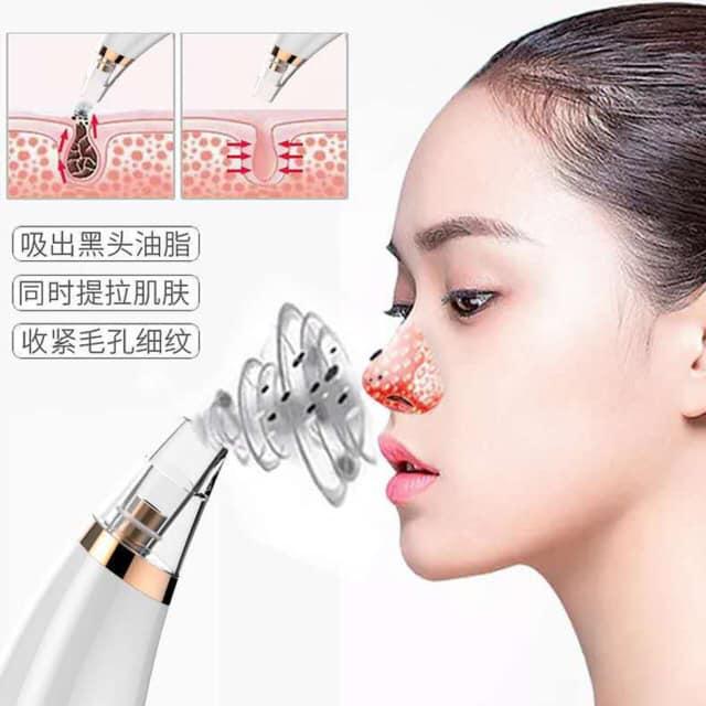 Máy Hút Mụn Cầm Tay Cao Cấp Black Head Detector - Giao Hàng Toàn Quốc