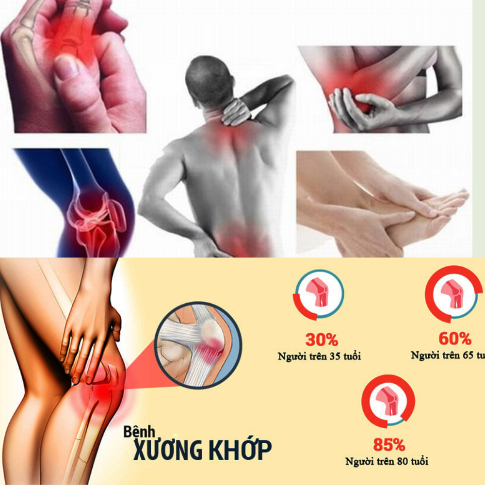 Viên Uống Xương Khớp AN THẢO ĐAN Hỗ trợ đau nhức xương khớp viêm khớp thoái hóa thoát vị tê bì chân tay, Hộp 60 viên