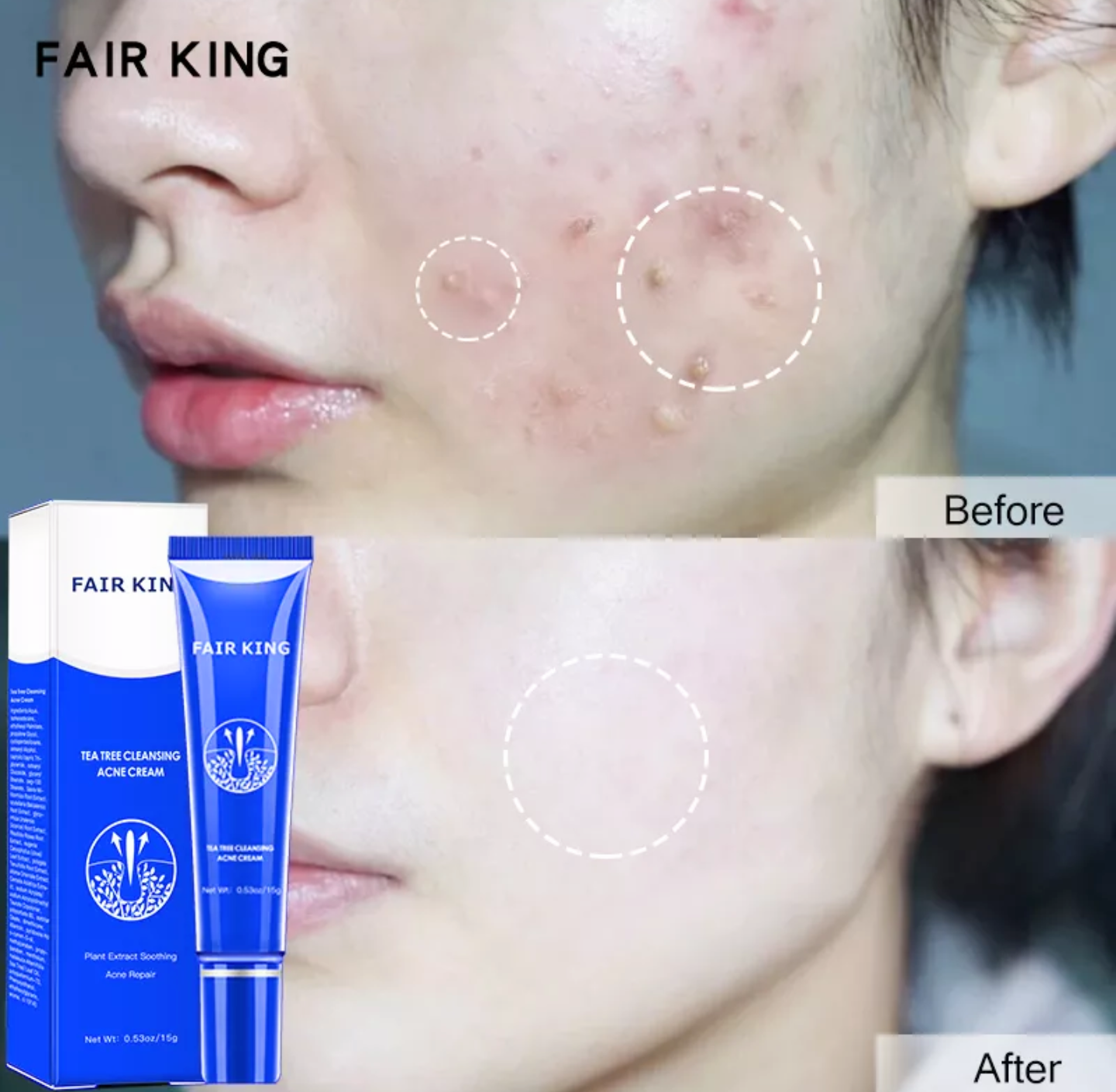 1 HỘP KEM TRỊ LOẠI BỎ MỤN LÀM MỜ CÁC VẾT SẸO TÀN NHANG DƯỠNG DA LÀM TRẮNG DA MẶT CAM KẾT HIỆU QUẢ HÀNG LOẠI TỐT