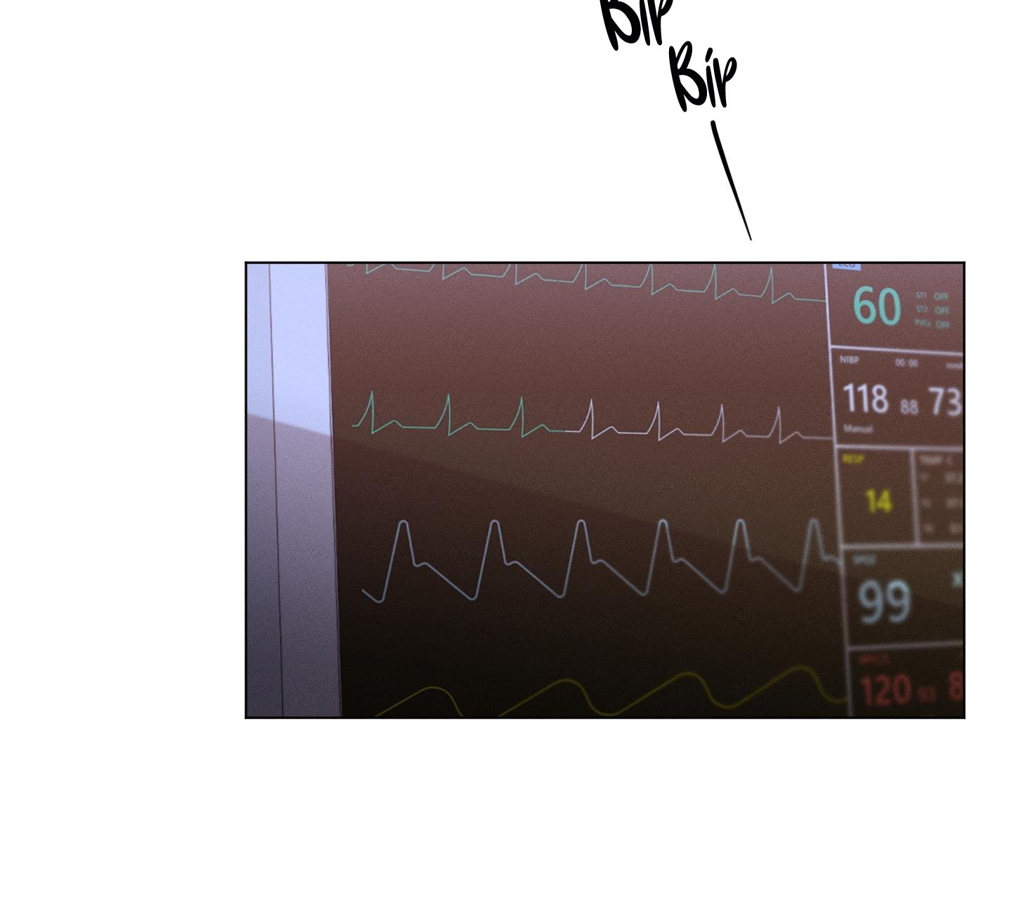 hội chứng minmotion chapter 60 44