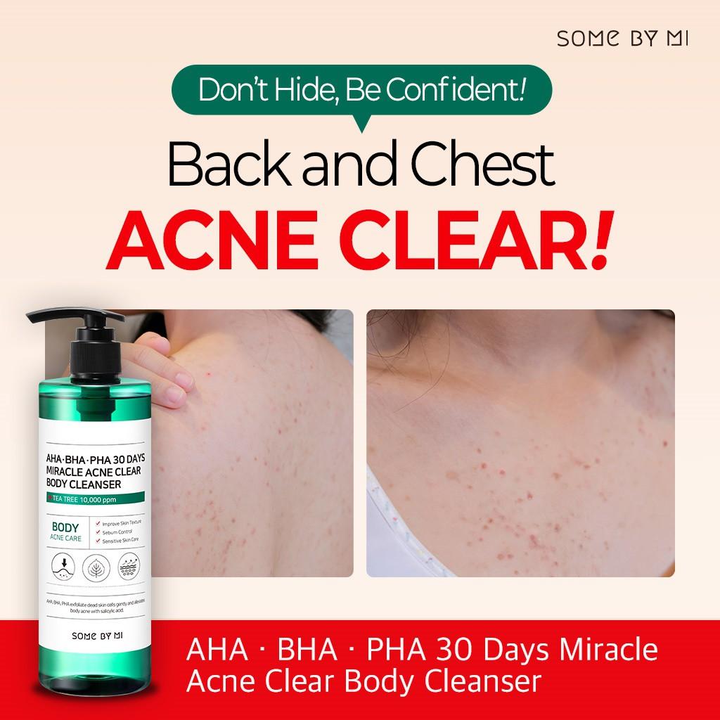 Sữa tắm ngừa mụn Some By Mi AHA-BHA-PHA 30Days Miracle Acne Clear Body Cleanser 400gr