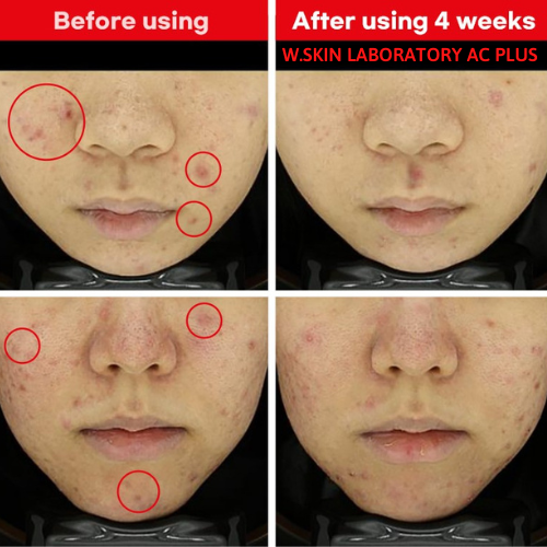 Kem dưỡng cho da mụn AC PLUS CLEARING CREAM