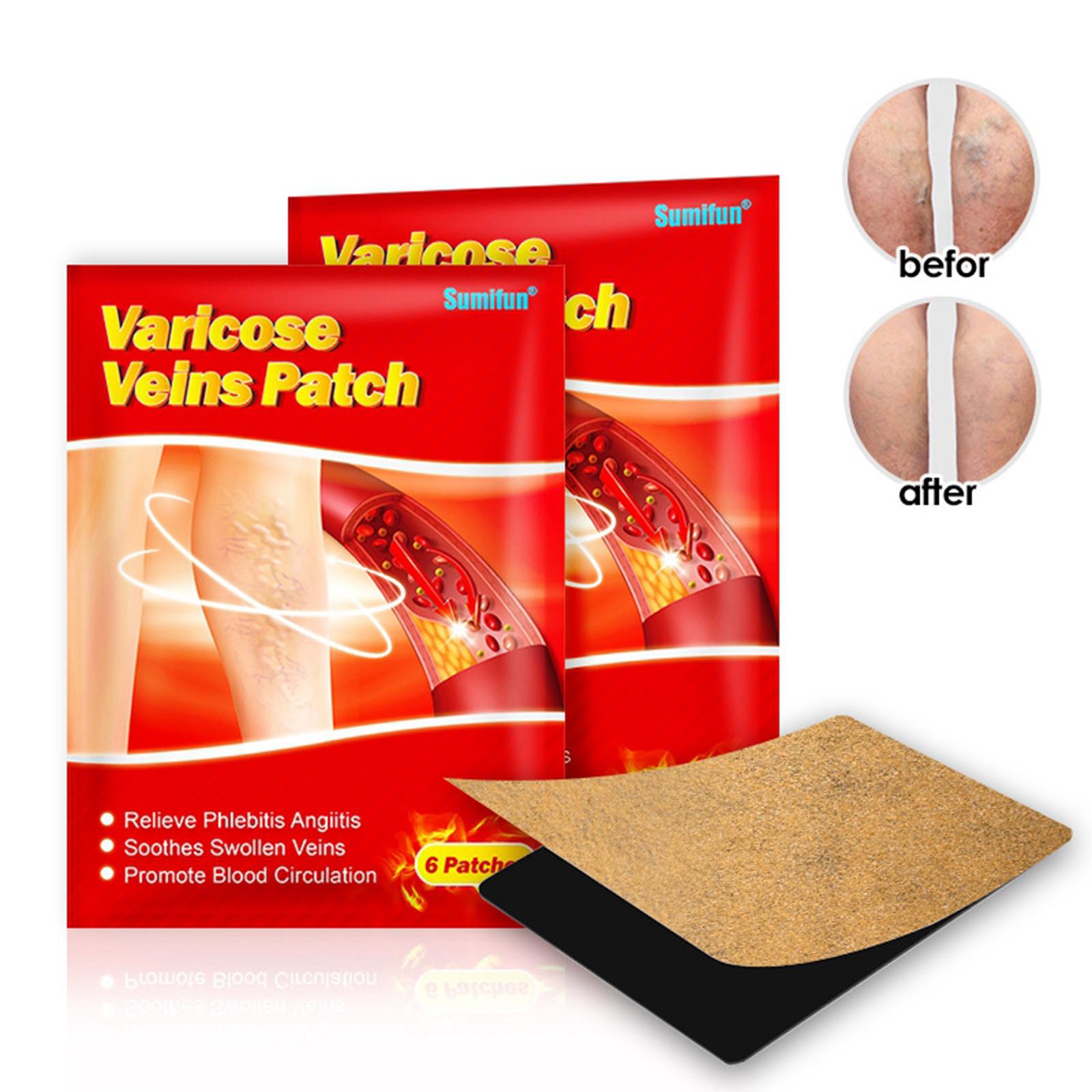 12Pcs Chinese Varicose Veins Plaster Varicosity Herbal Back Patch 7x10 cm